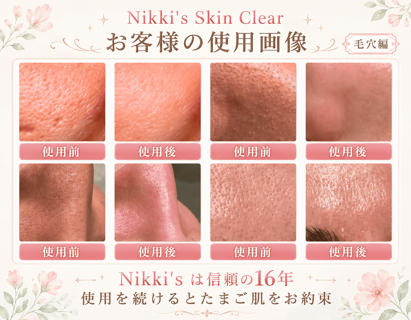 ニッキーズスキンクリア 使用者様使用例2