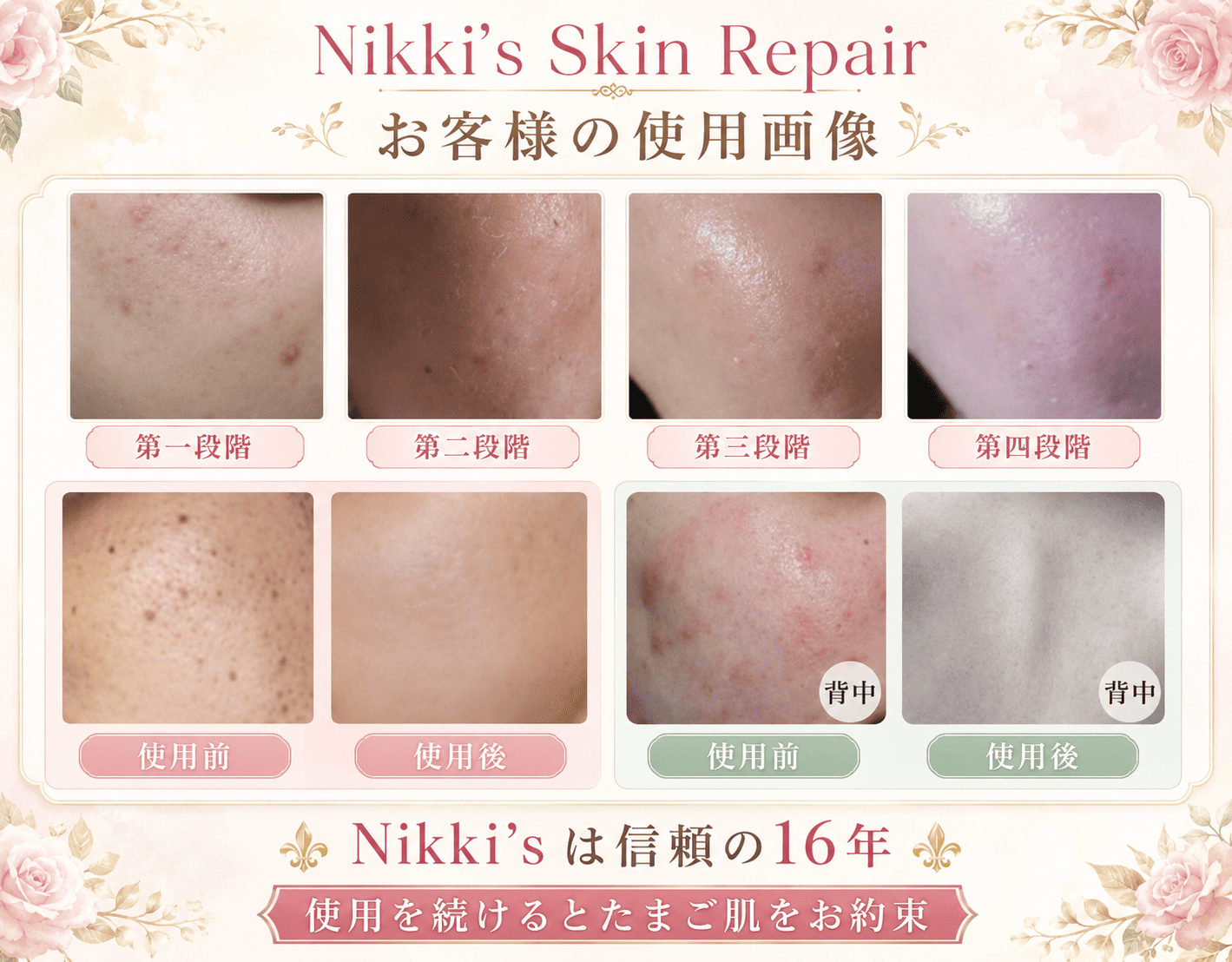 Nikki's Skin Repair お客様の使用画像2